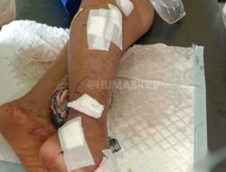 Ngeri,!! Gigit Buaya Muara Peria Ini Patah Tulang Kaki Dan Luka Luka 
